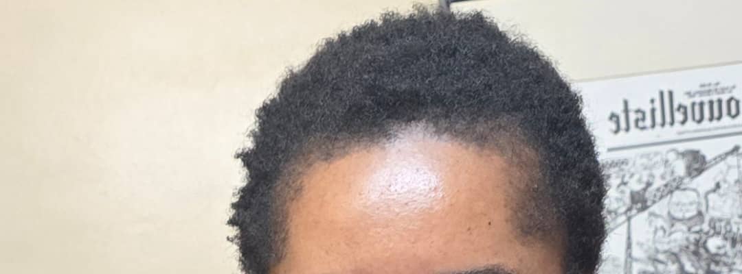 Anti-Dandruff and Hydrate Set of 6 UNISEX